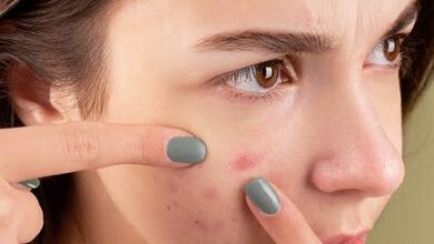 common acne treatment errors